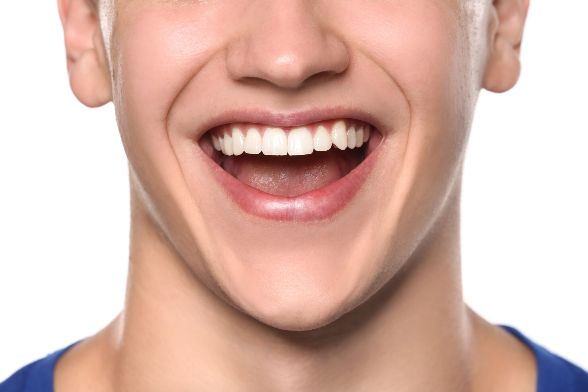 sheridan porcelain veneers