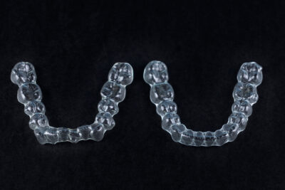 clear aligners