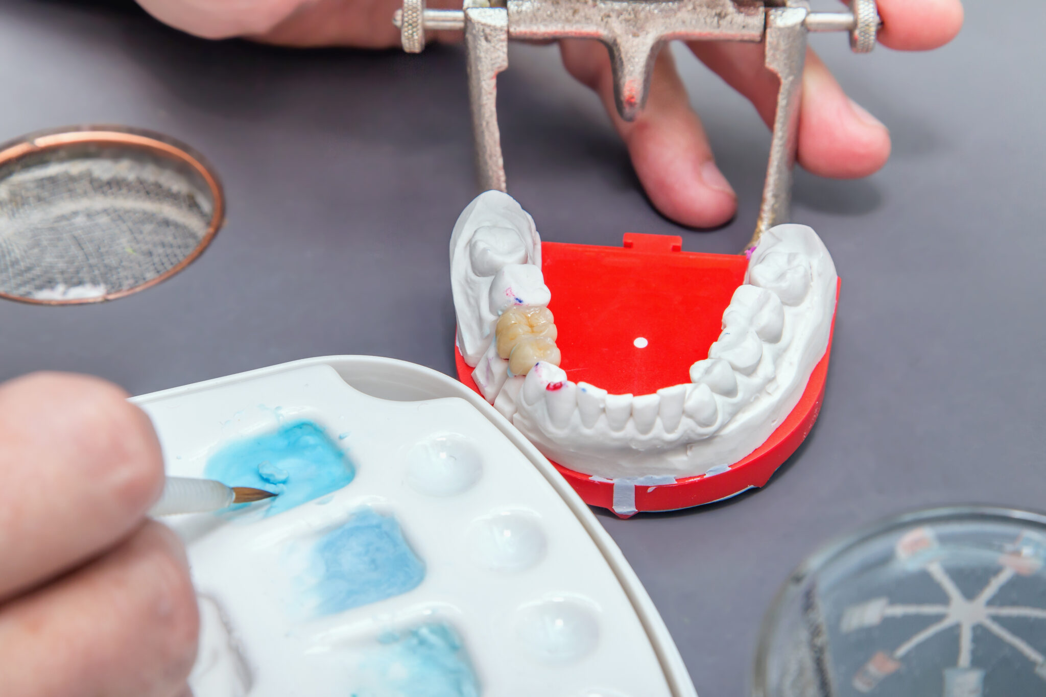 sheridan dental bridge