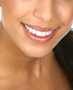 sheridan teeth whitening
