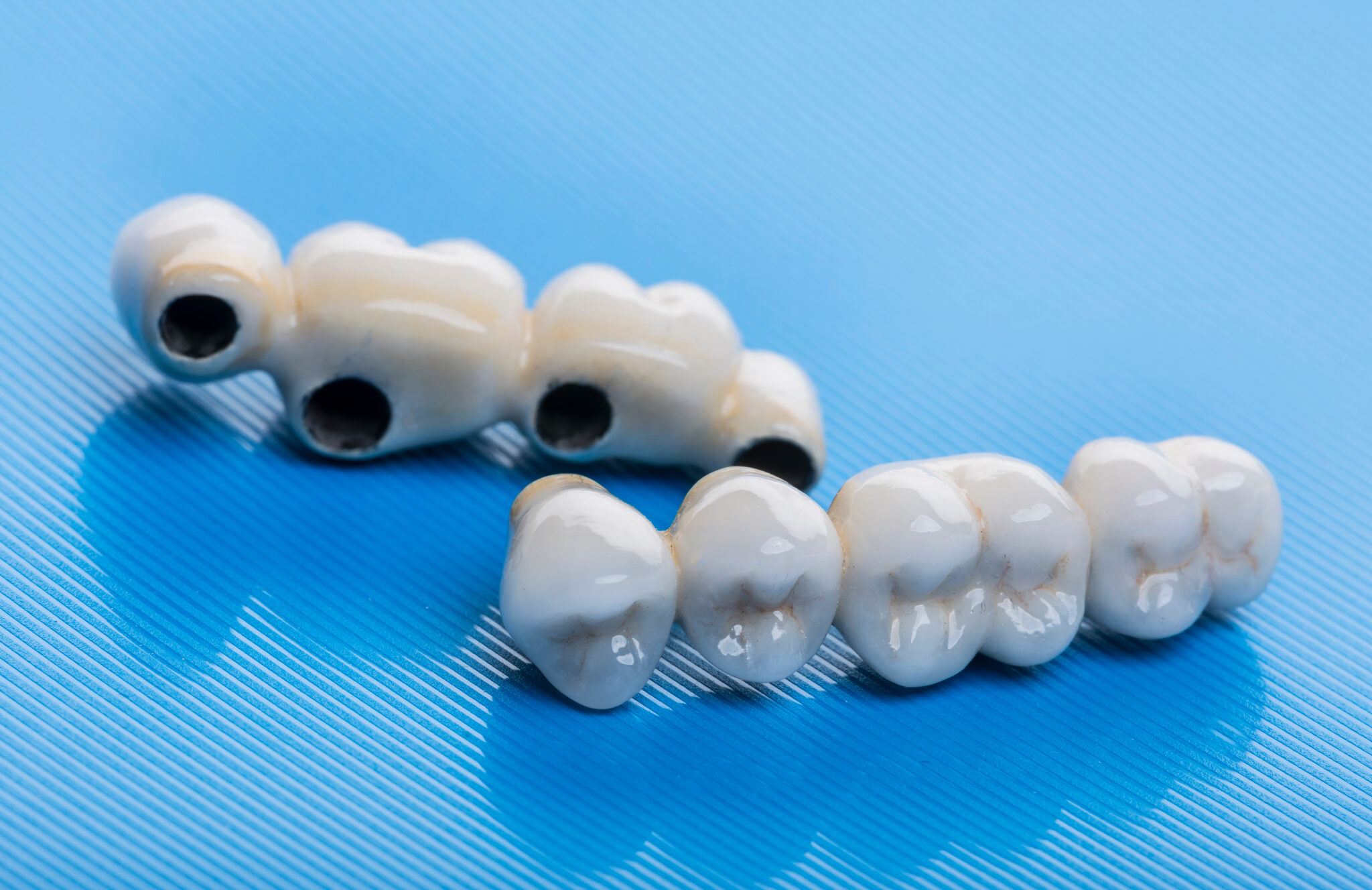 sheridan dental bridges