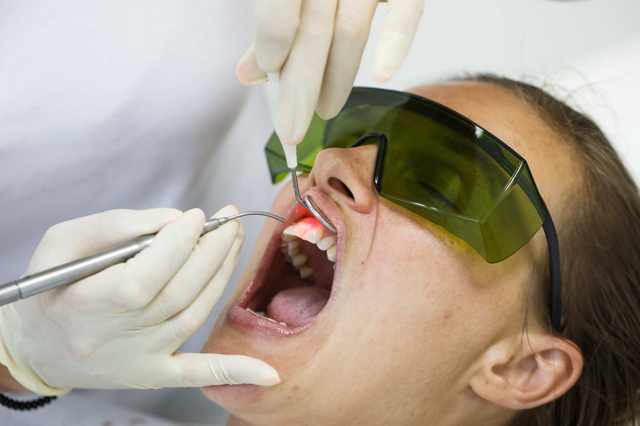 sheridan dental lasers
