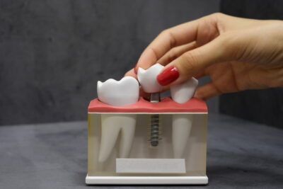 sheridan dental implants