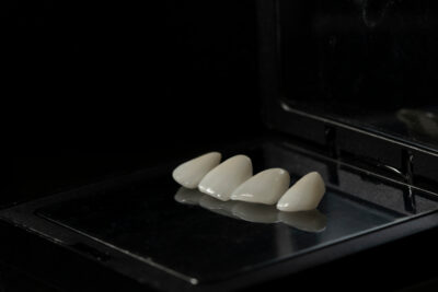 sheridan porcelain veneers