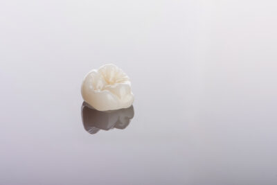 Grinnell CEREC