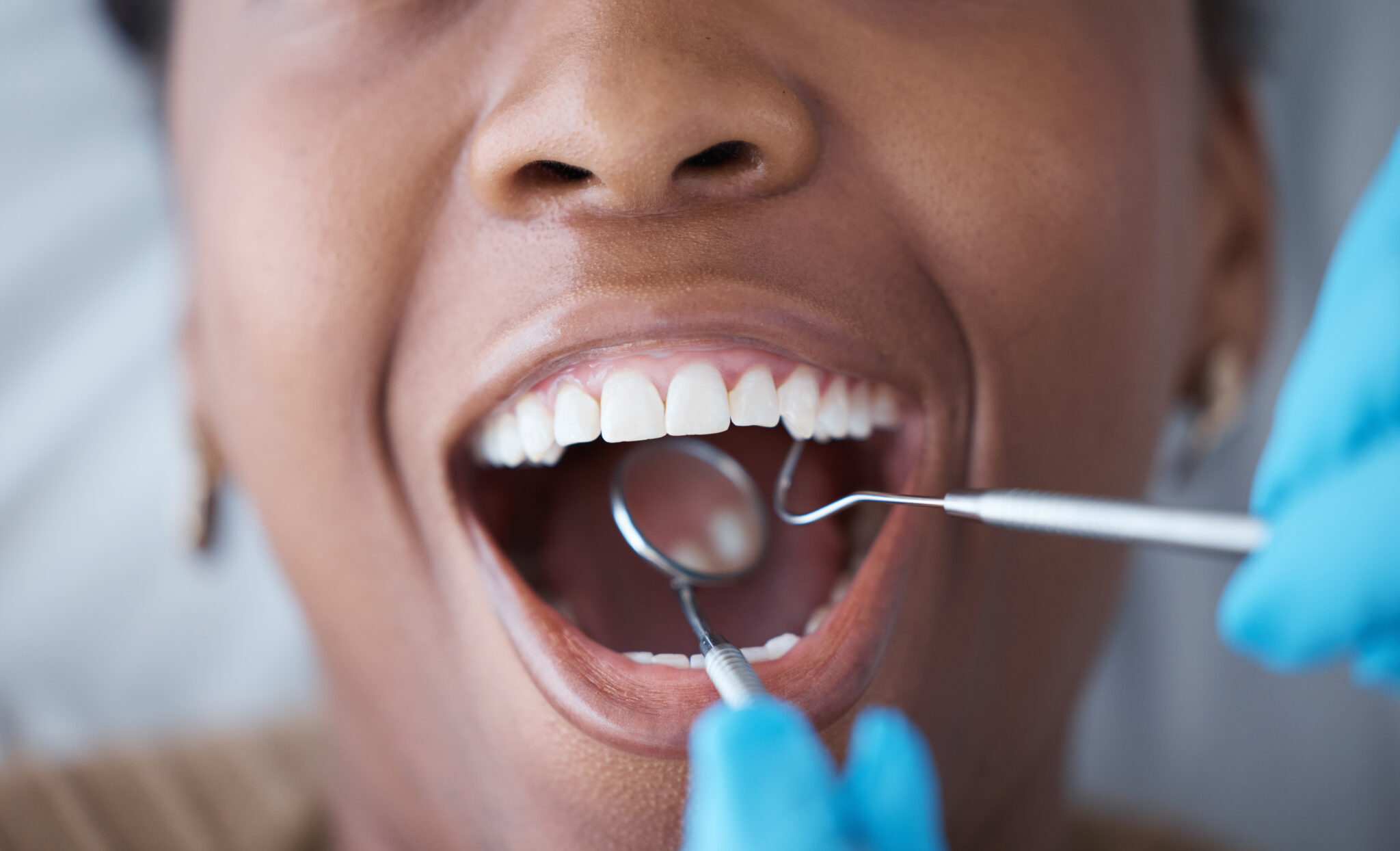 sheridan teeth whitening