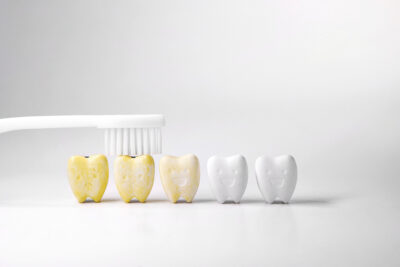 tooth stains