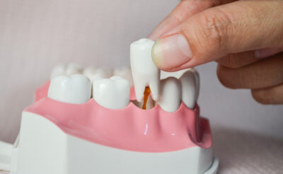 tooth loss sheridan. wy