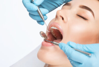 dental bonding sheridan wy